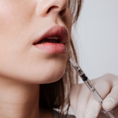 Lip Filler Injection in Pakistan